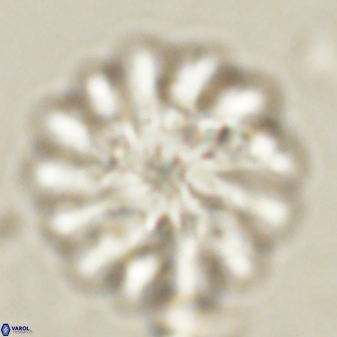 Discoaster tortinodosus 60976