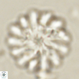 Discoaster tortinodosus 60976