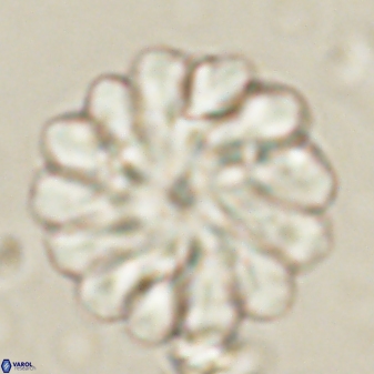 Discoaster tortinodosus 60977