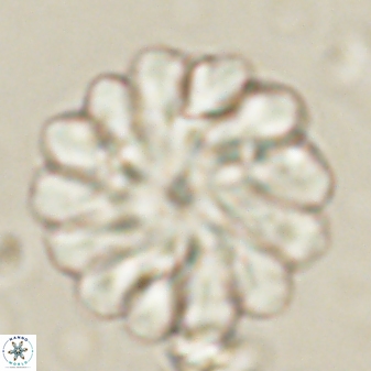 Discoaster tortinodosus 60977