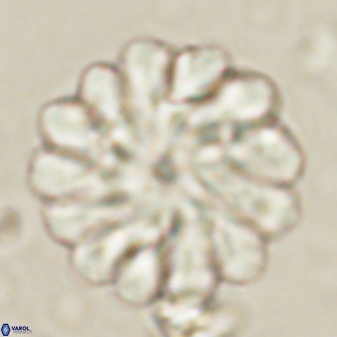 Discoaster tortinodosus 60978