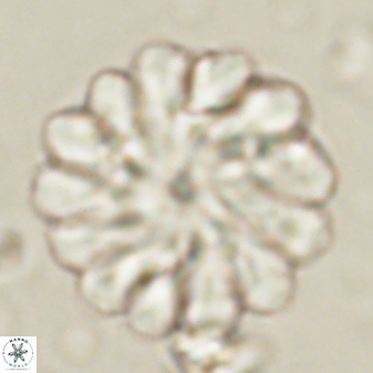 Discoaster tortinodosus 60978