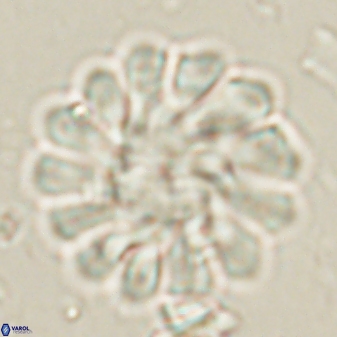 Discoaster tortinodosus 60979