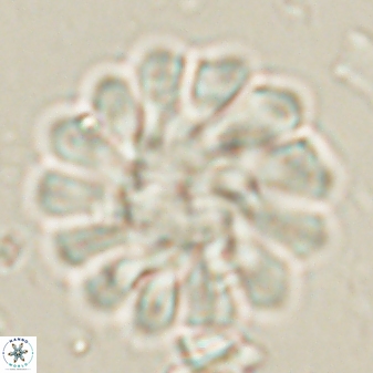 Discoaster tortinodosus 60979
