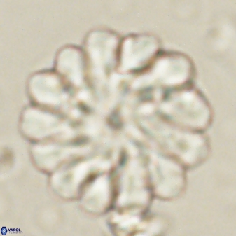 Discoaster tortinodosus 60980