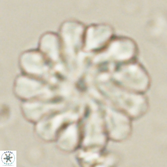 Discoaster tortinodosus 60980