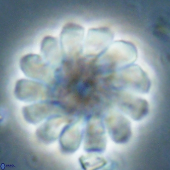 Discoaster tortinodosus 60981
