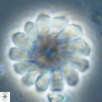 Discoaster tortinodosus 60981