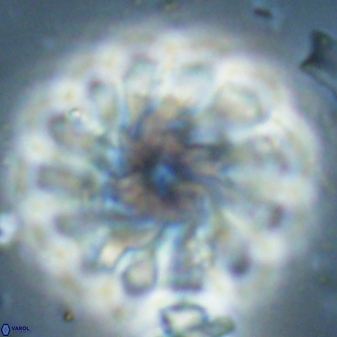 Discoaster tortinodosus 60982