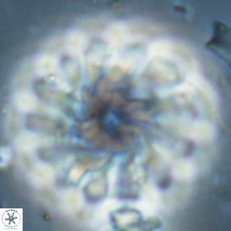 Discoaster tortinodosus 60982