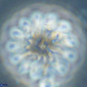 Discoaster tortinodosus 60983
