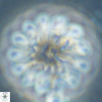 Discoaster tortinodosus 60983