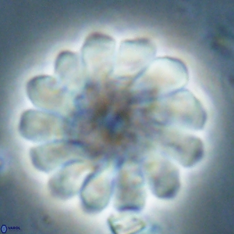 Discoaster tortinodosus 60984