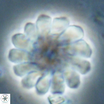 Discoaster tortinodosus 60984