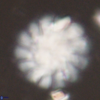 Discoaster tortinodosus 60985