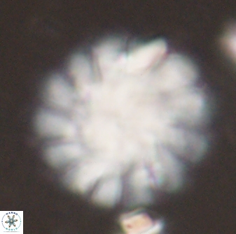 Discoaster tortinodosus 60985