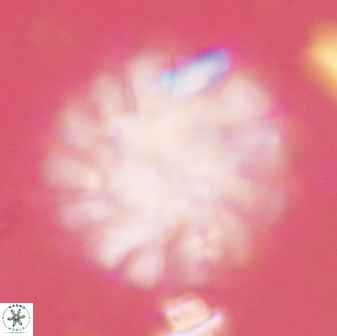 Discoaster tortinodosus 60986