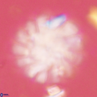 Discoaster tortinodosus 60987