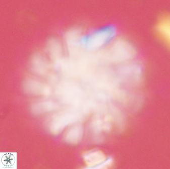 Discoaster tortinodosus 60987