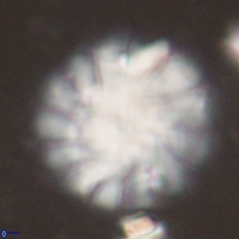 Discoaster tortinodosus 60988
