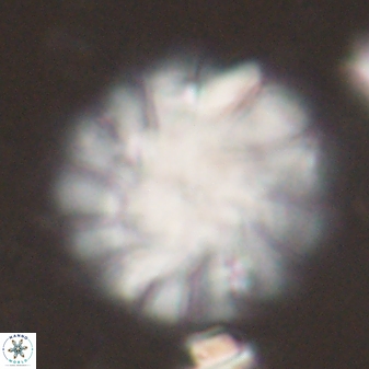 Discoaster tortinodosus 60988