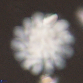 Discoaster tortinodosus 60989