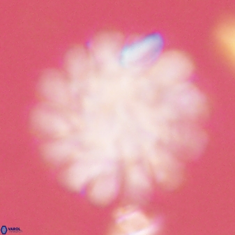 Discoaster tortinodosus 60990