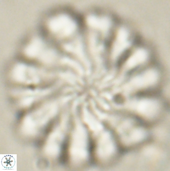 Discoaster tortinodosus 60924