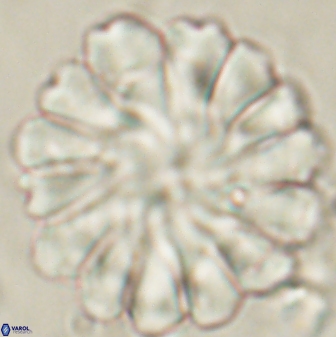 Discoaster tortinodosus 60925