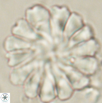 Discoaster tortinodosus 60925