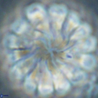 Discoaster tortinodosus 60926