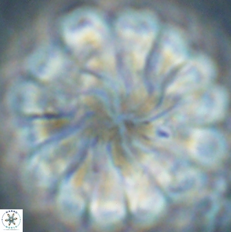 Discoaster tortinodosus 60926