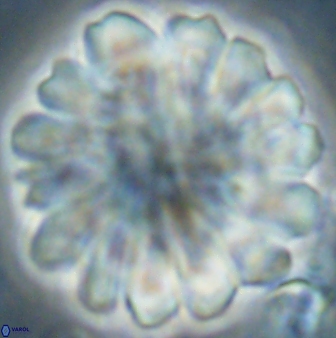 Discoaster tortinodosus 60927