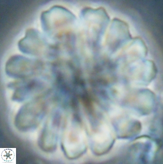 Discoaster tortinodosus 60927