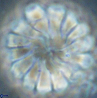 Discoaster tortinodosus 60928
