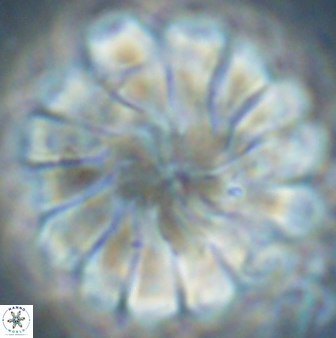 Discoaster tortinodosus 60928