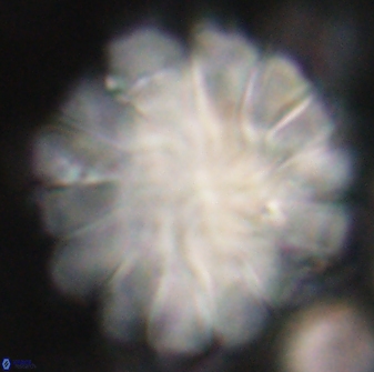 Discoaster tortinodosus 60929