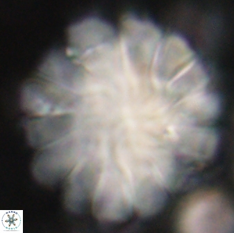Discoaster tortinodosus 60929