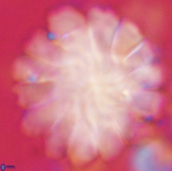 Discoaster tortinodosus 60930
