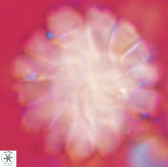 Discoaster tortinodosus 60930
