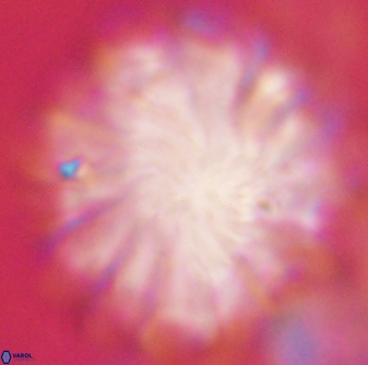 Discoaster tortinodosus 60931