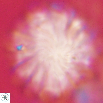 Discoaster tortinodosus 60931