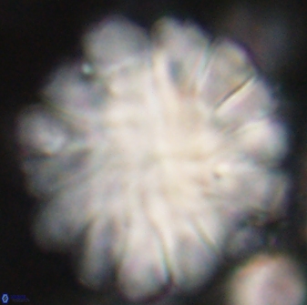 Discoaster tortinodosus 60933