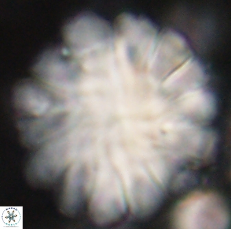 Discoaster tortinodosus 60933