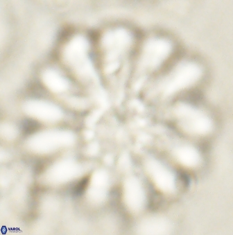 Discoaster tortinodosus 61050