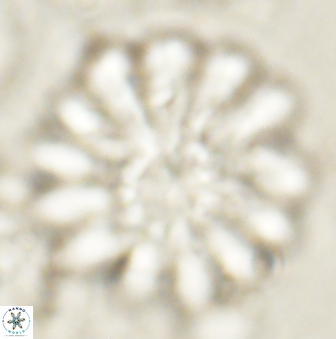 Discoaster tortinodosus 61050