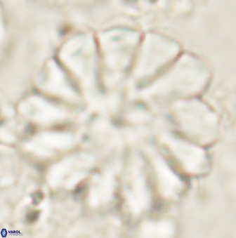 Discoaster tortinodosus 61051