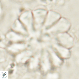 Discoaster tortinodosus 61051