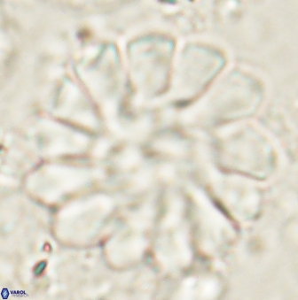 Discoaster tortinodosus 61052