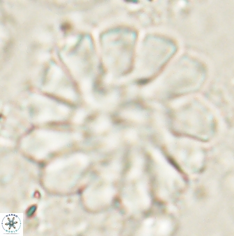 Discoaster tortinodosus 61052